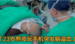 91年小伙脑出血直播,直播全程记录生死瞬间！”